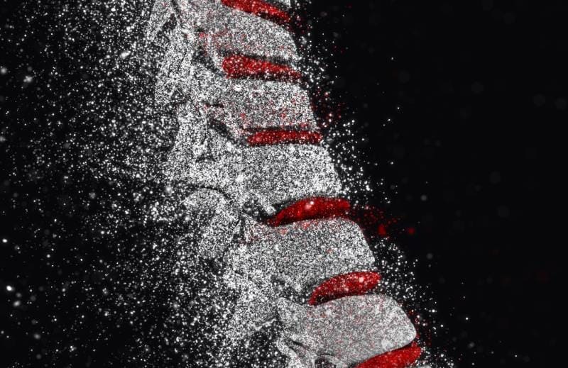 Diagnóstico y tratamiento de Fracturas patológicas de la columna vertebral  ofrecido  por él Dr. Adrián Abrego - Especialista en Neurocirugía y Cirugía de Columna