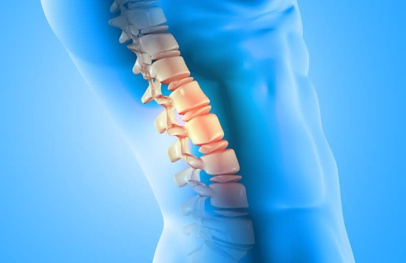 Tratamiento de fracturas traumáticas de la columna vertebral  ofrecido  por él Dr. Adrián Abrego - Especialista en Neurocirugía y Cirugía de Columna